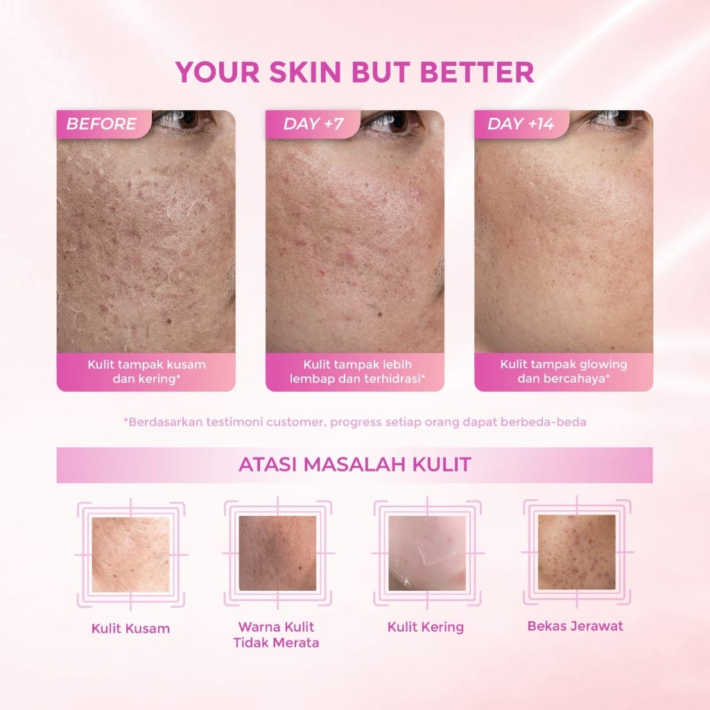 LUMIWHITE - Paket Whitening Series  (FREE 1 SACHET RNDM+CLOUD PADS+POUCH)