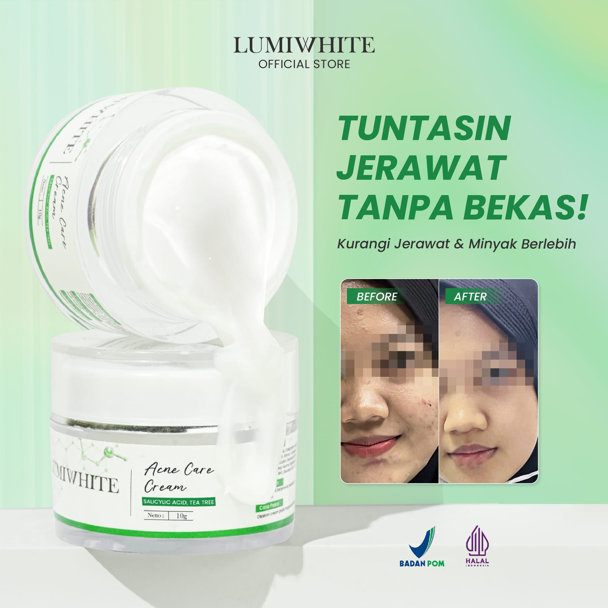 LUMIWHITE - Acne Care Cream  - Mengatasi Jerawat (FREE 1 CLOUD PADS)