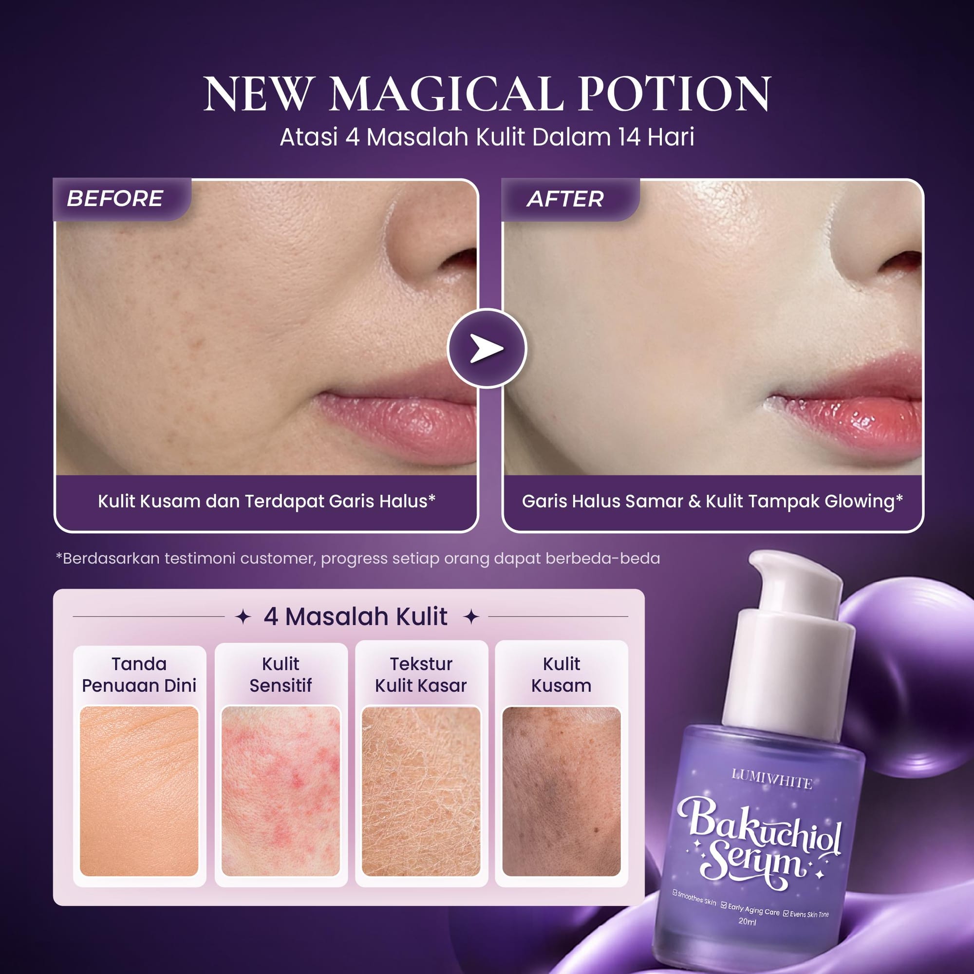LUMIWHITE - Bakuchiol Serum 20ml (Anti aging, Mencerahkan, Teksture kulit)  (FREE 1 CLOUD PADS)