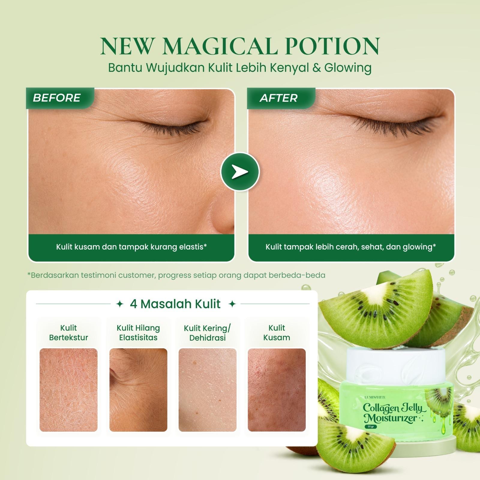 LUMIWHITE – Collagen Jelly Moisturizer 20gr (FREE 1 CLOUD PADS)