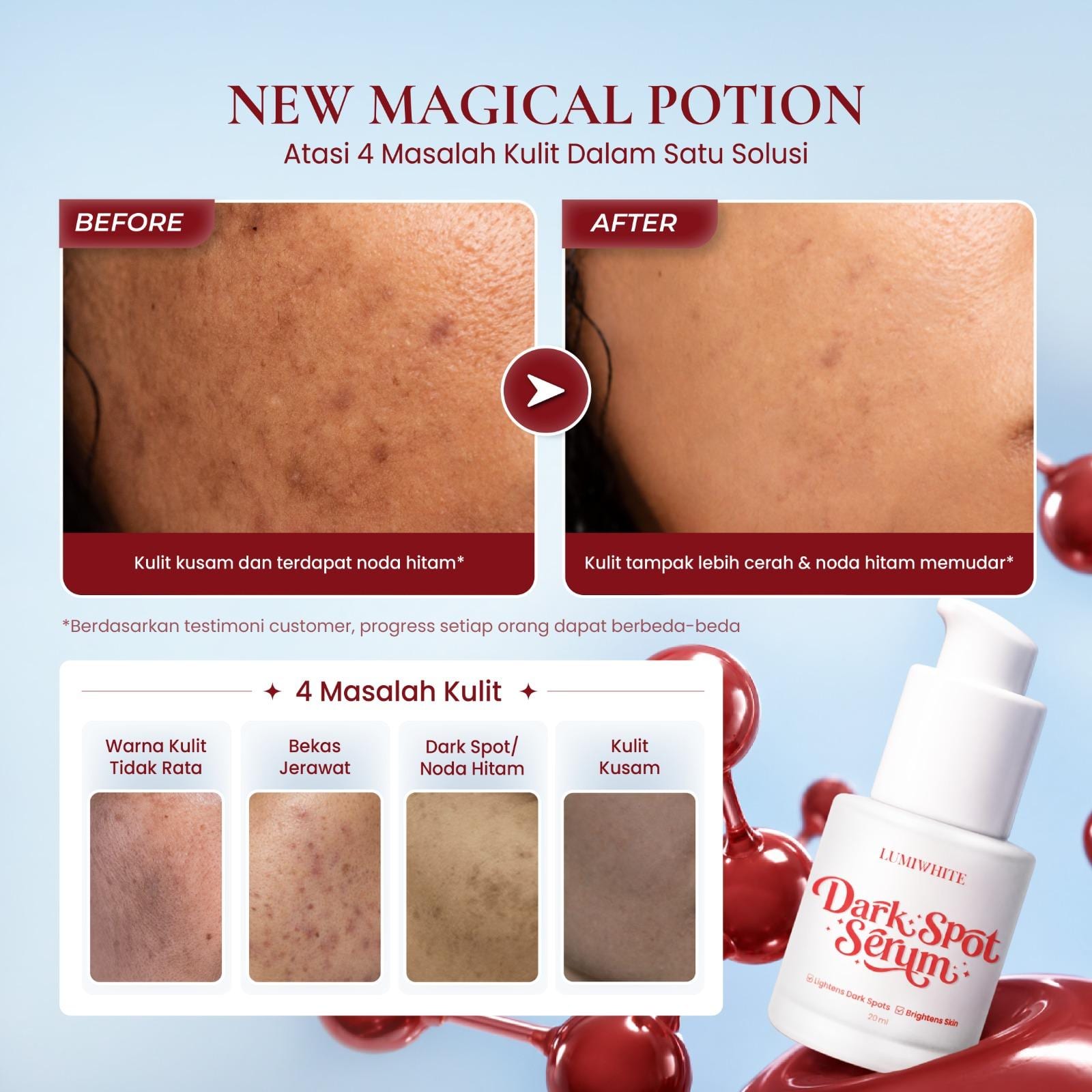 LUMIWHITE - Darkspot Serum 20ml (Melasma Booster) (FREE 1 CLOUD PADS)